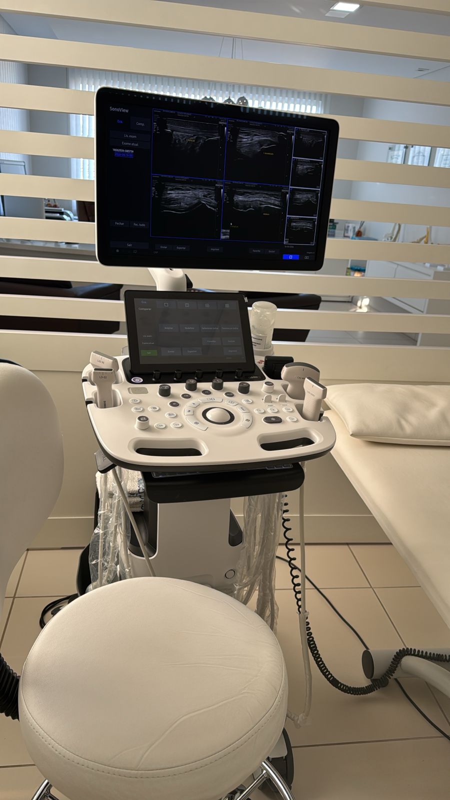 Equipamento de ultrassonografia